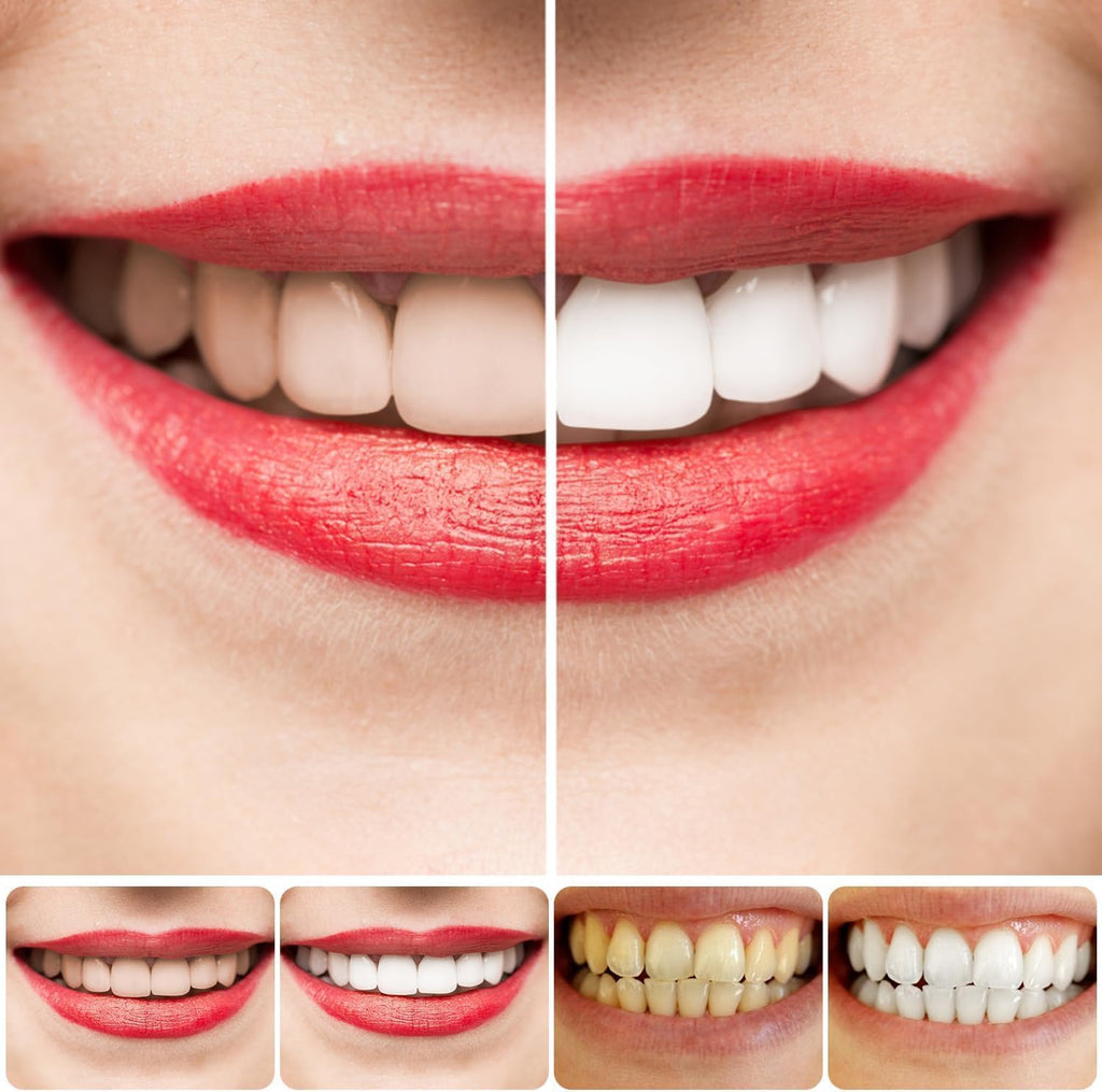 HR Stain removal toothpaste