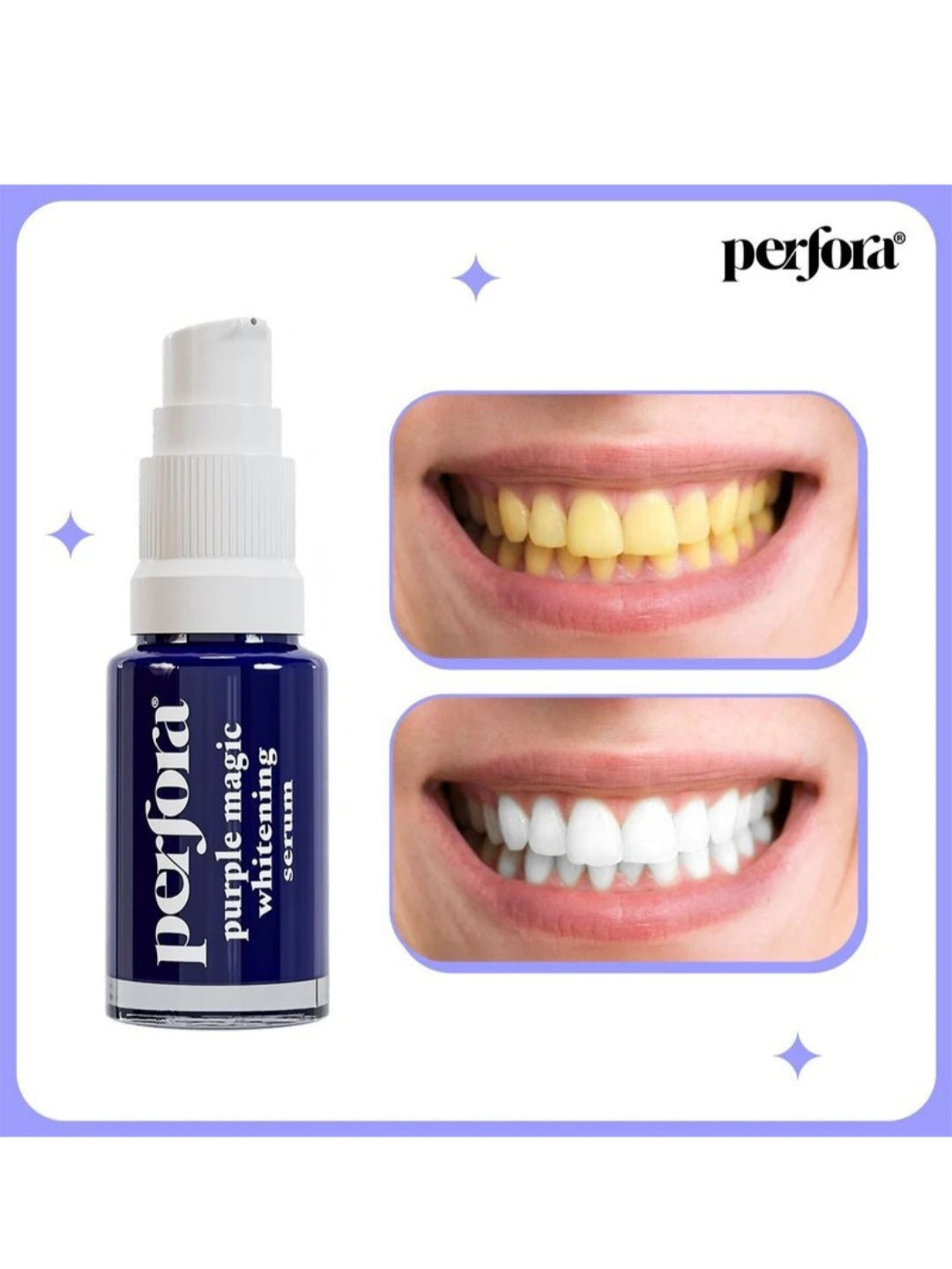 magic teeth whitening purple serum